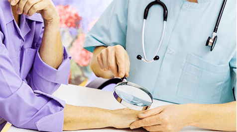 Diagnosis and treatment of papillomas
