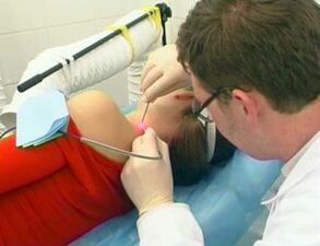 How to get rid of the papillomas in the body