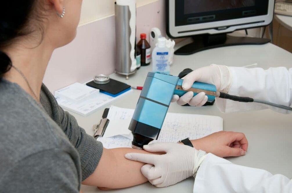 methods for treating warts on the body